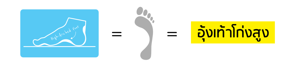 A vector illustration of a high-arched foot in Thai language